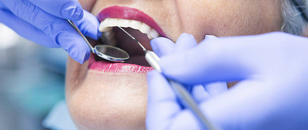 Best Emergency Dentist for Lost Fillings or Crowns in Elberton, GA